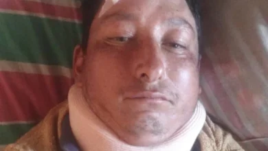 El trabajador estaría postrado luego de ser atropellado