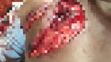 Un hombre se debate entre la vida y la muerte tras cornada de toro en la parroquia Matus, el domingo 22 de septiembre de 2024