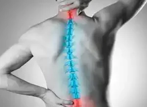 Quiropraxia: Alivio efectivo para el dolor de espalda y cuello en Riobamba