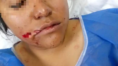 Mujer recibió 9 puñaladas y sobrevivió, el agresor es su expareja