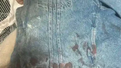 El joven baleado en Riobamba sería por ajuste de cuentas. Las investigaciones de la Fiscalía de Chimborazo continúan