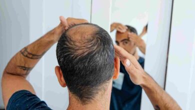Tratamientos efectivos para la alopecia: Minoxidil y Finasteride