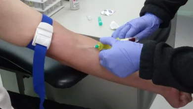 Latacunga: casos VIH incrementa en detección temprana.