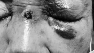 Hombre había agredido a adultos mayores luego de un accidente