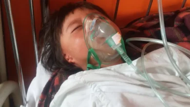 Niño con paladar hendido requiere operación urgente. Su vida es de permanente lucha por sobrevivir