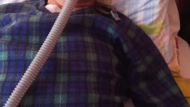 Payaso 'Botoncito' requiere ayuda solidaria de Riobamba