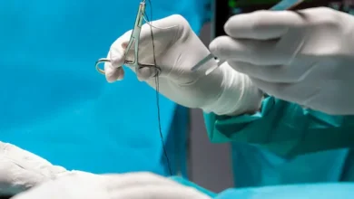 Guía para acceder a una vasectomía en Ecuador 2025.