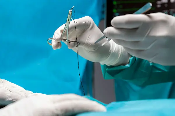 Guía para acceder a una vasectomía en Ecuador 2025.