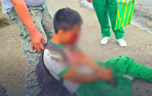 Estudiante herido tras caer de un carro en movimiento