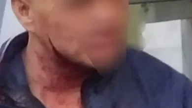 Hombre y mujer atacados por extranjero en Riobamba