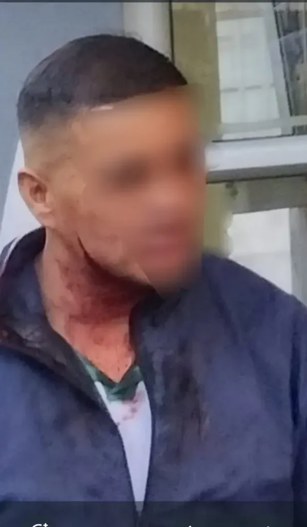 Hombre y mujer atacados por extranjero en Riobamba