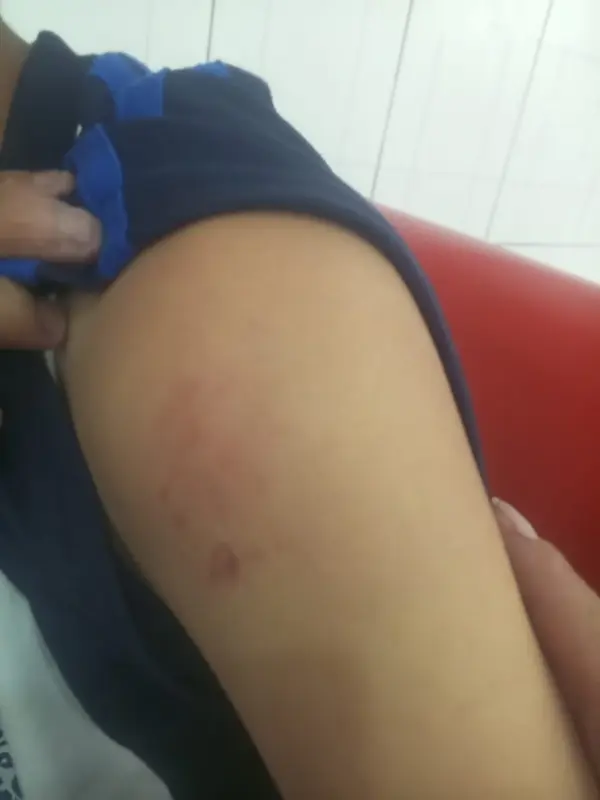 Su madre quiere que esto no le pase a ningún otro niño