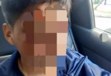 Niño de 11 años de Riobamba atacado en su escuela
