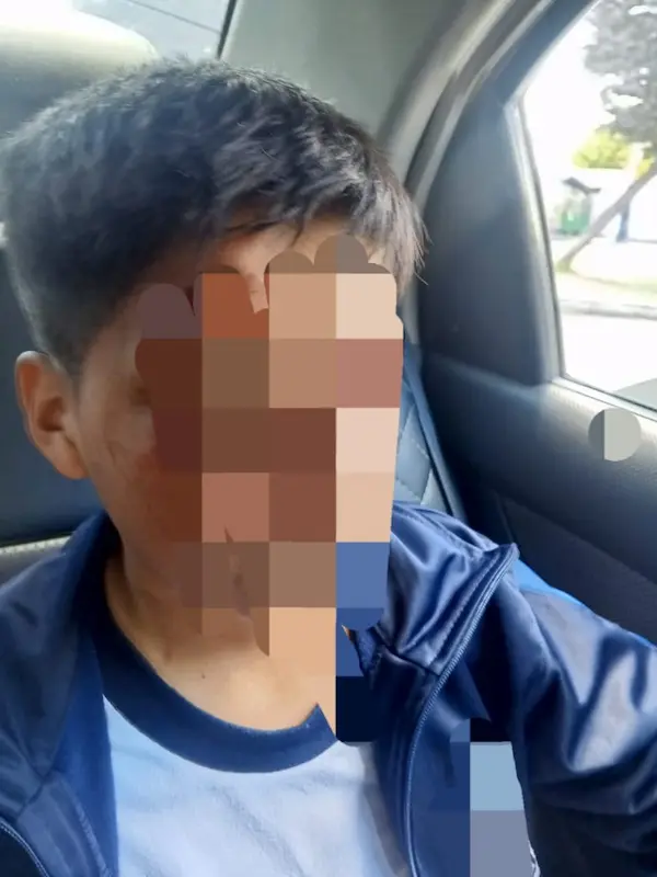 Niño de 11 años de Riobamba atacado en su escuela