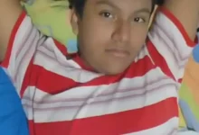 Joven necesita ayuda para continuar con sus tratamientos