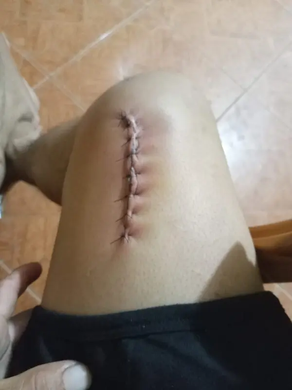 La primera herida que le propinó el llamado "toro de la oración"