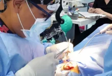 Cirugía plástica gratis de labio leporino en Guaranda: fechas y cómo acceder