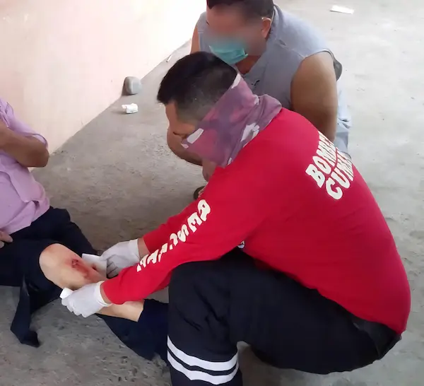 Lo importante es no intervenir, dejar que los profesionales actúen