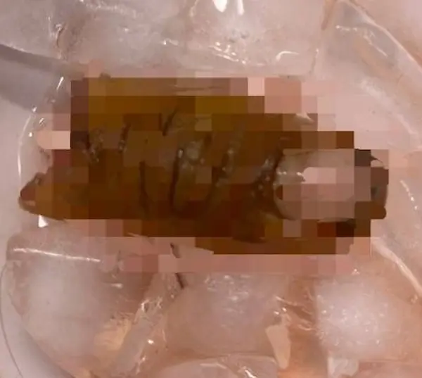 El dedo cercenado en el accidente doméstico