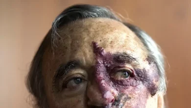 Mariano Barbacid: descrubre la cura del cáncer de páncreas