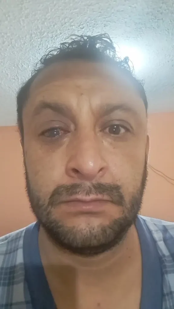 Accidente laboral podría dejar ciego a hombre de Riobamba