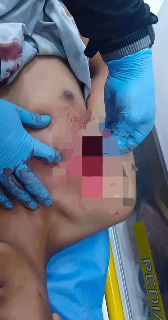 Una de las heridas abiertas estaba por el hombro