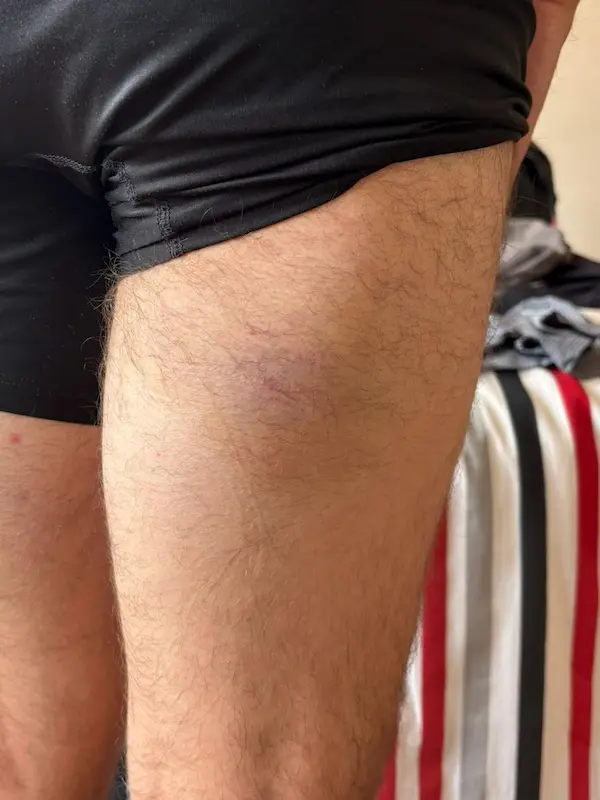 Las piernas también cuentan la pesadilla que vivió