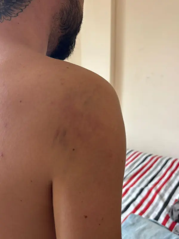 Los golpes pueden curarse, pero el daño psicológico permanece