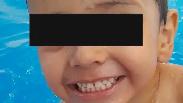 Niño que falleció por negligencia médica